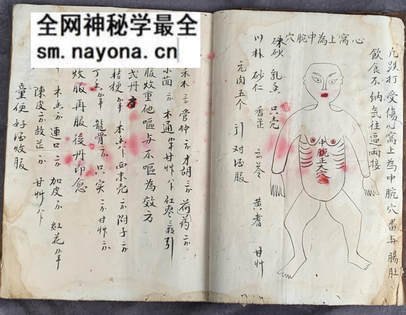 《梅山张五郎跌打医书》