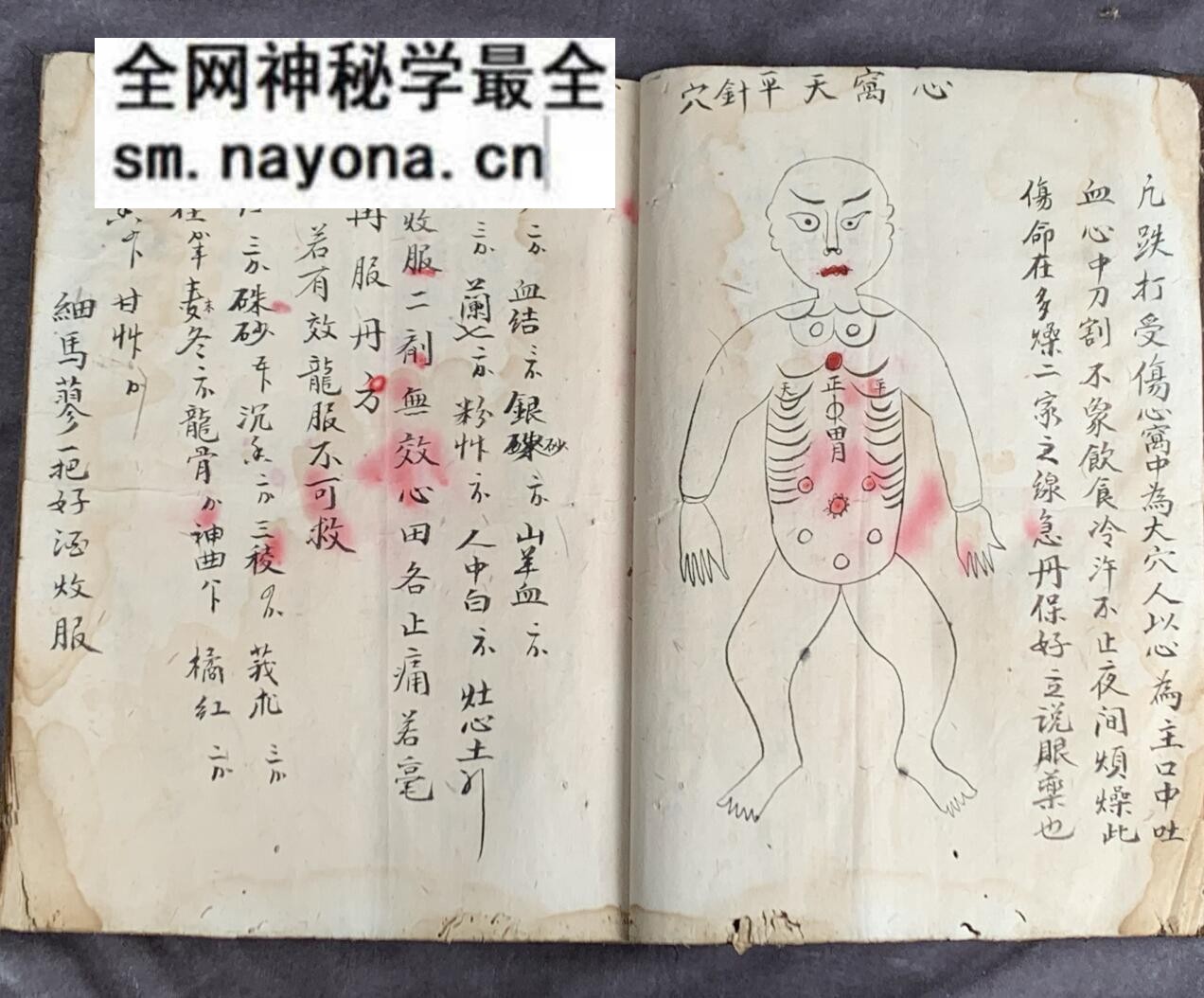 《梅山张五郎跌打医书》