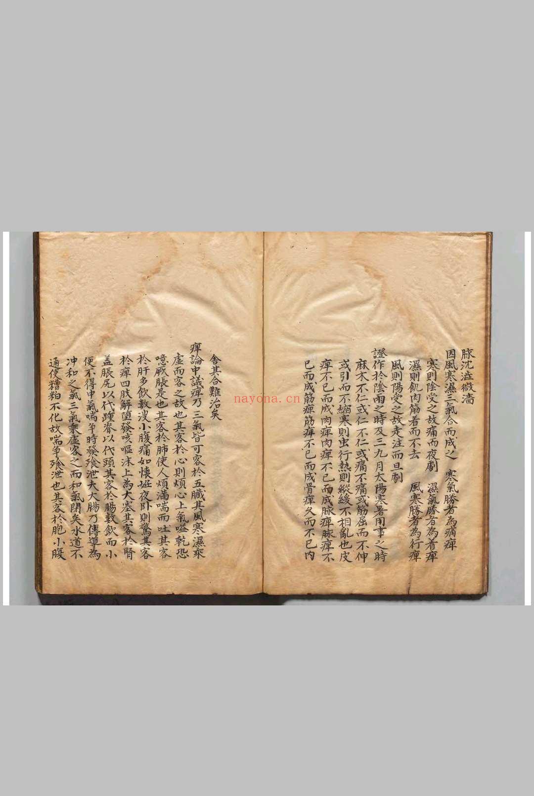 丹溪朱氏脉因证治 朱震亨（元）