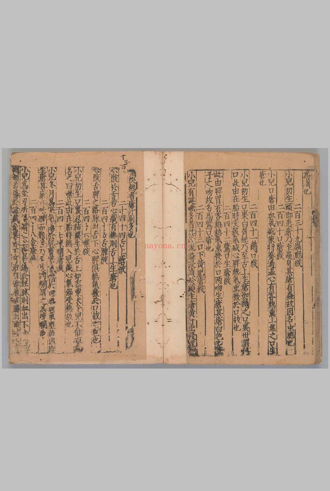 诸病源候论50卷.目1卷隋.巢元方撰.[宋末元初]刊([建])[修]