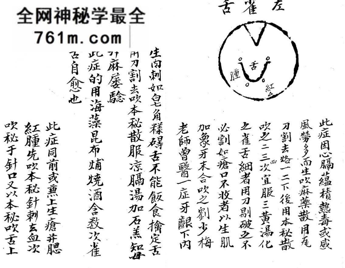 中医古籍《咽喉秘传》