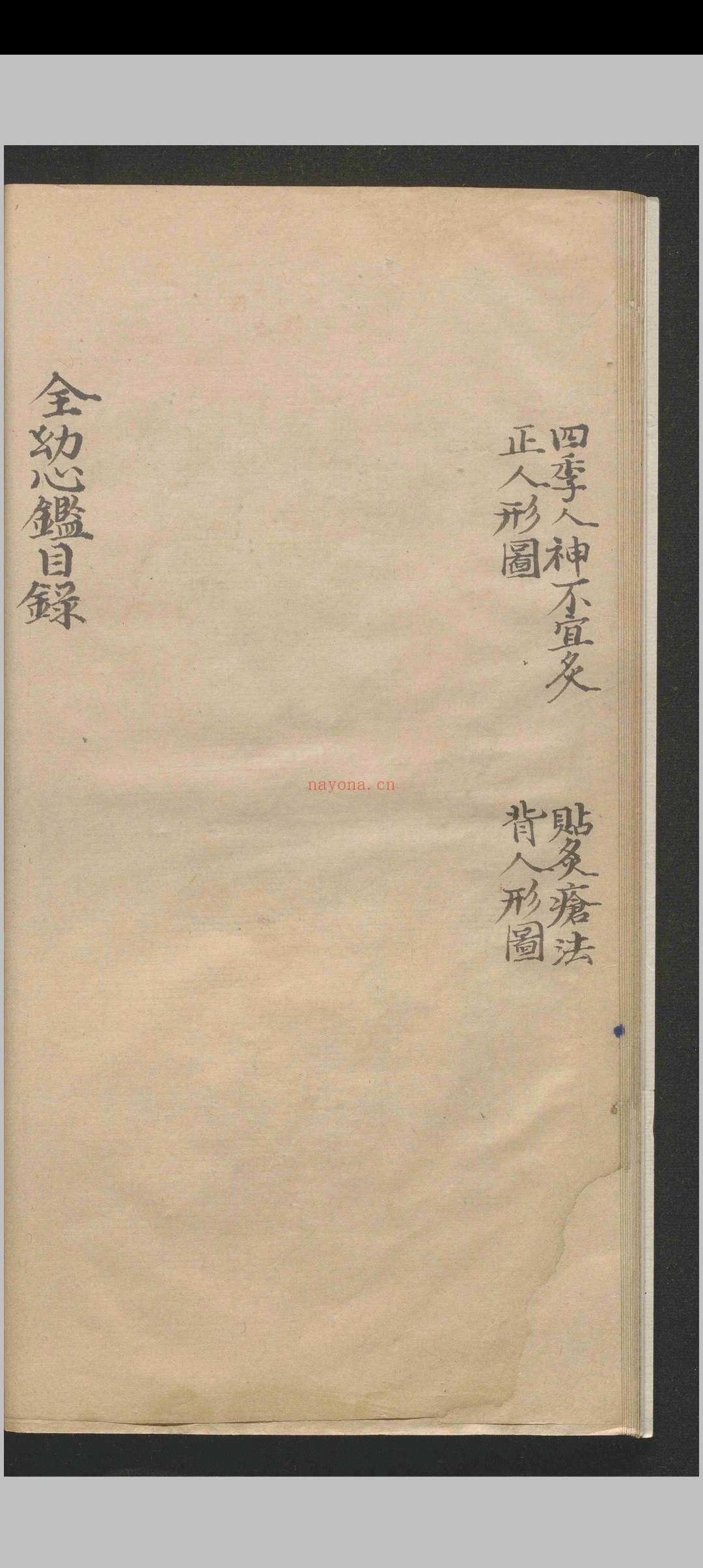 全幼心鉴.四卷.寇平.明成化四年