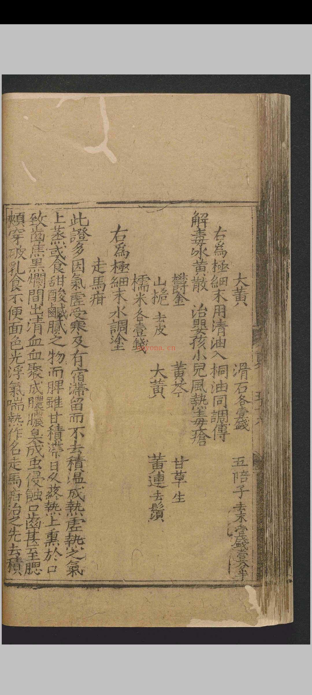 全幼心鉴.四卷.寇平.明成化四年