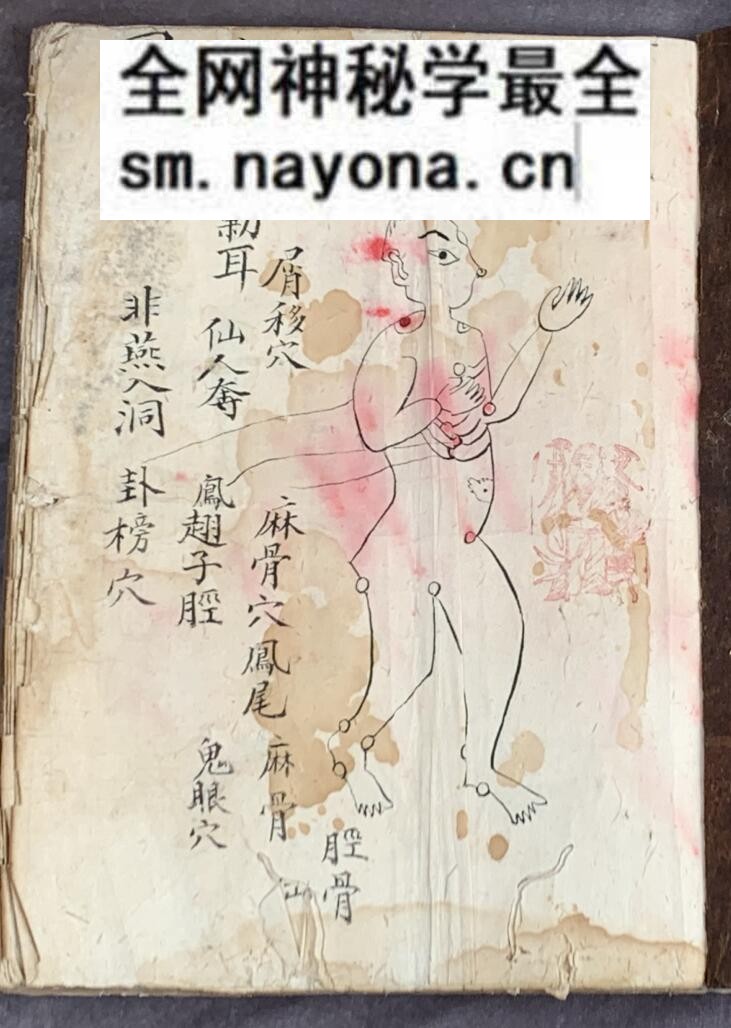 《梅山张五郎跌打医书》
