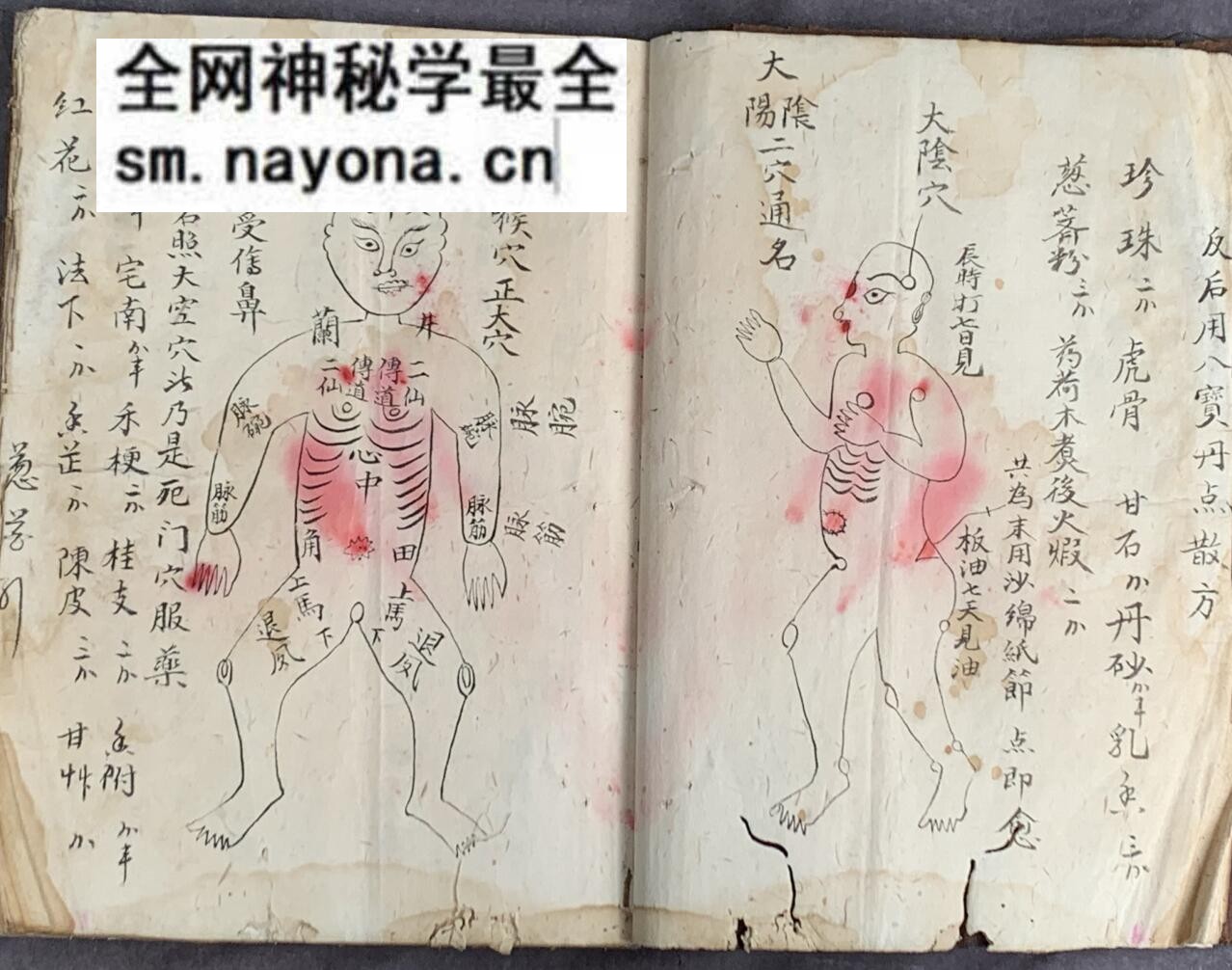 《梅山张五郎跌打医书》