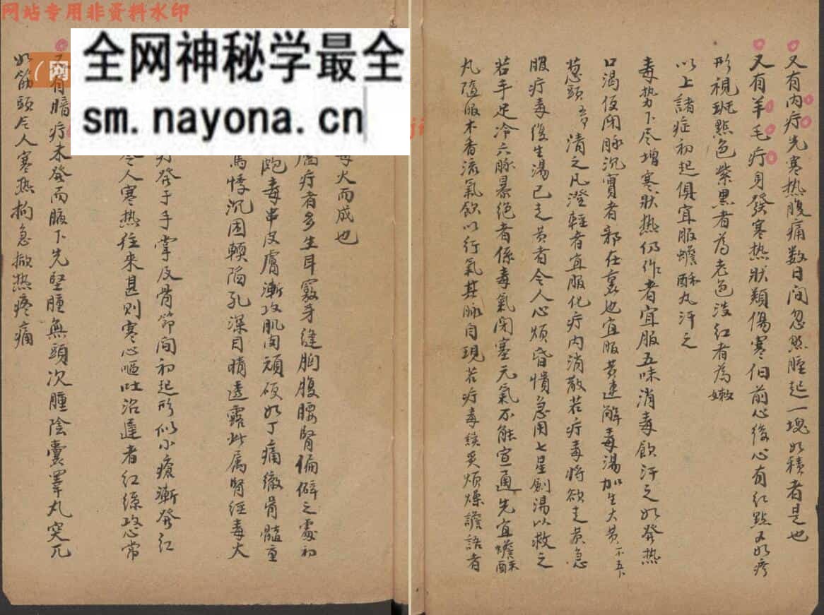 医宗金鉴.外科心法