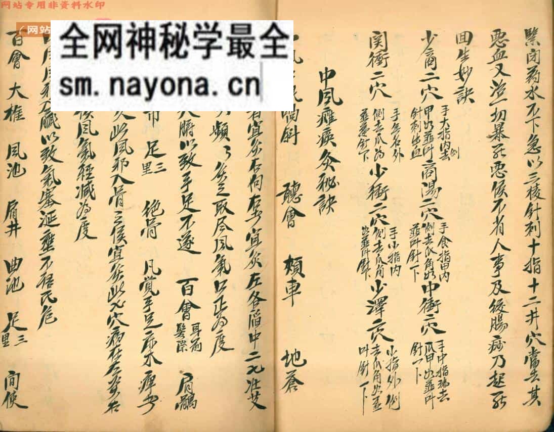 《针灸秘穴》李寿亭记