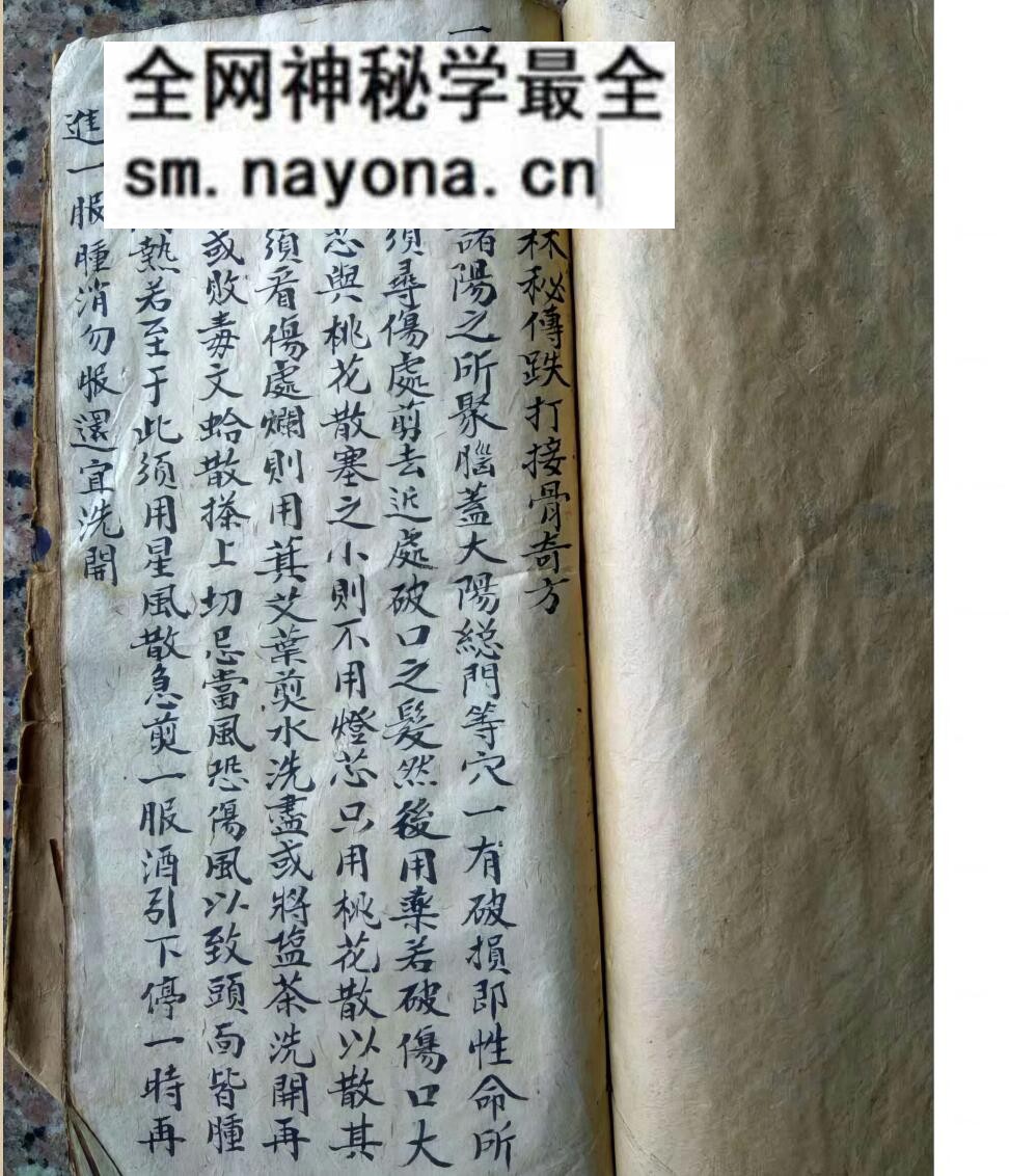 中医方书古籍《少林秘传跌打接骨奇方》