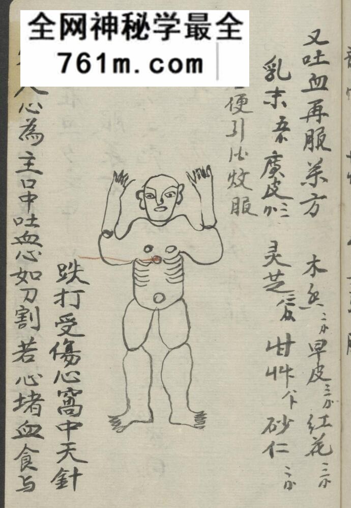 中医跌打古籍《跌打损伤》