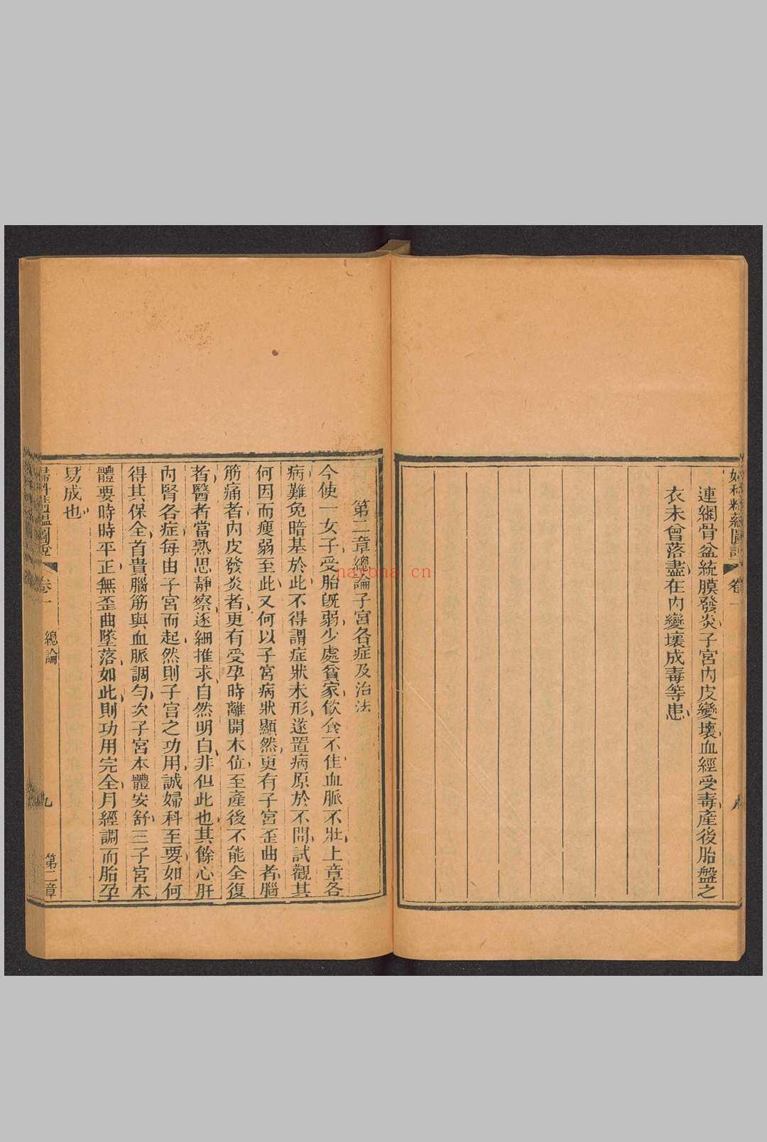 妇科精蕴图说 5卷 光绪15年(1889)羊城博济医局藏版