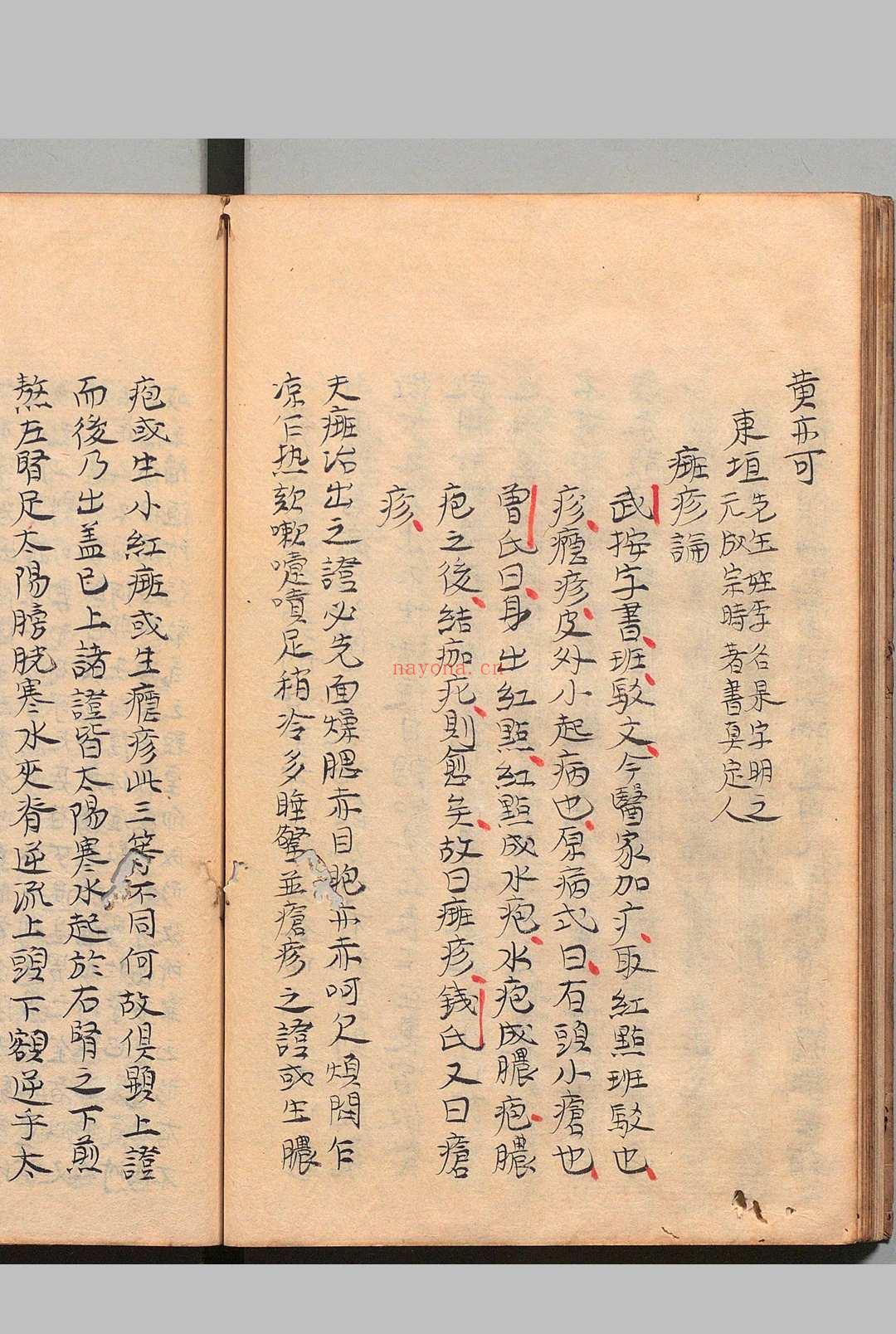 痘疹正宗 4卷 高武(明)写本 ,江户