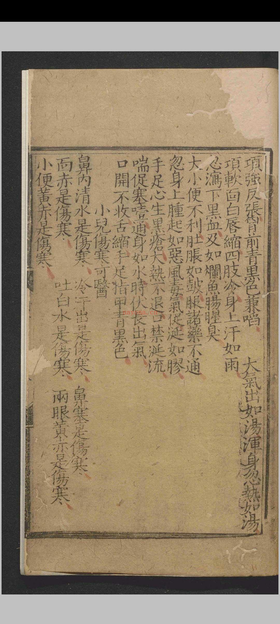 全幼心鉴.四卷.寇平.明成化四年