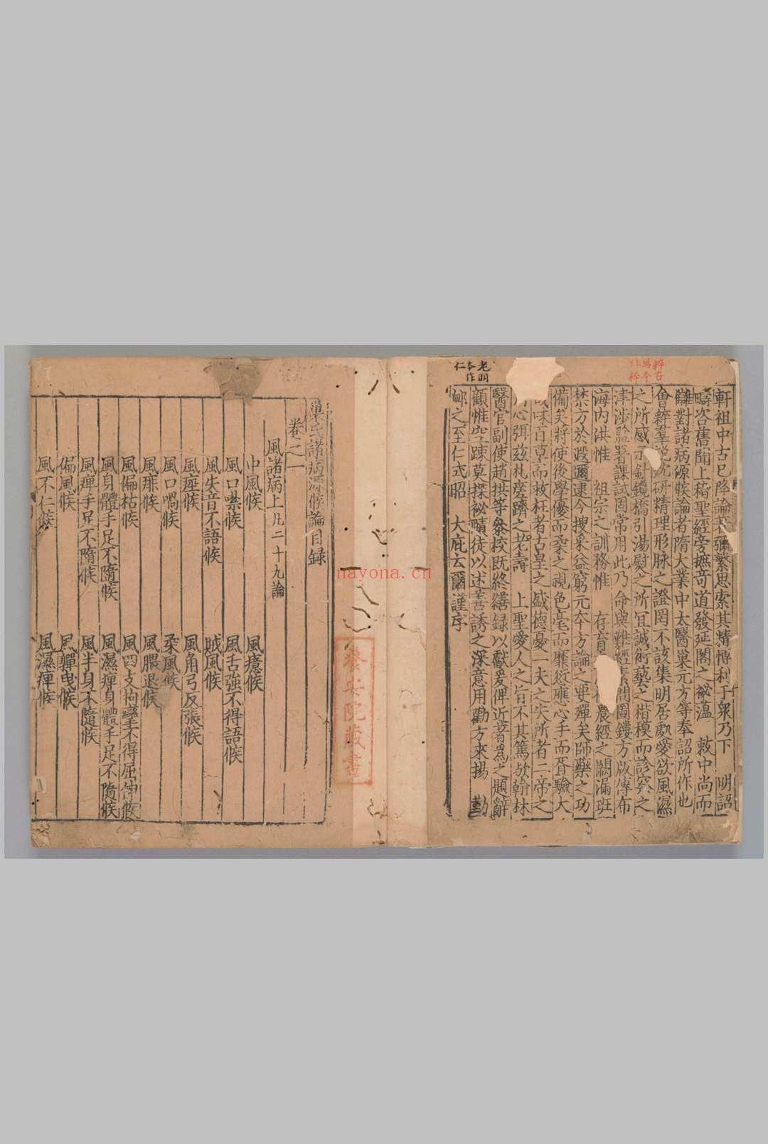 诸病源候论50卷.目1卷隋.巢元方撰.[宋末元初]刊([建])[修]
