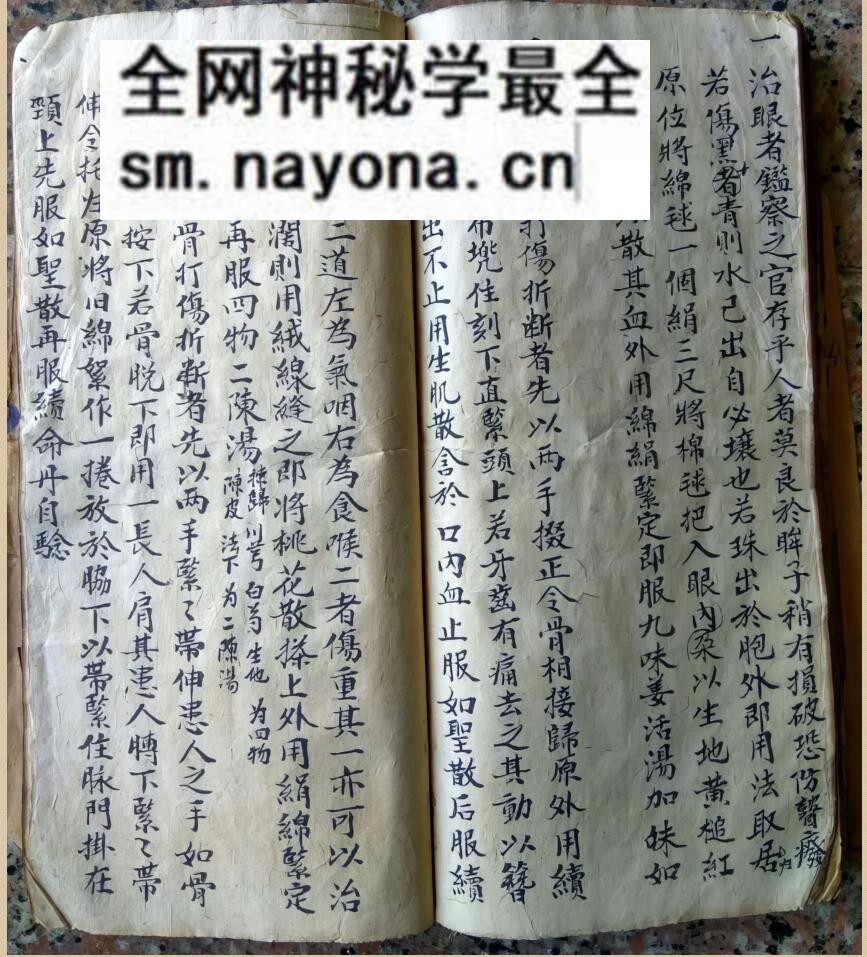 中医方书古籍《少林秘传跌打接骨奇方》