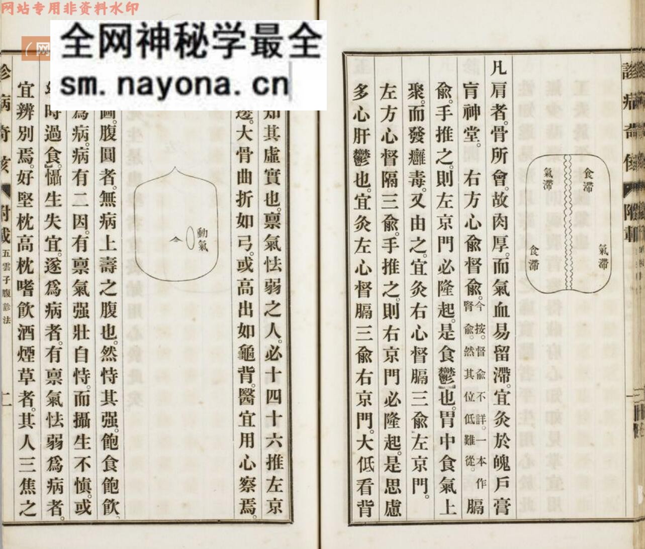 《诊病奇侅》