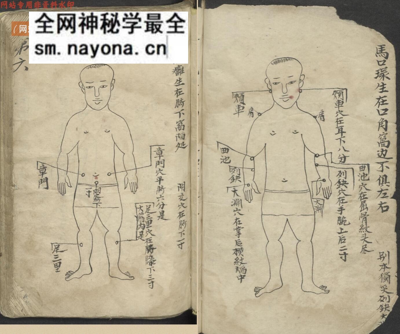 中医古籍《百症图说》