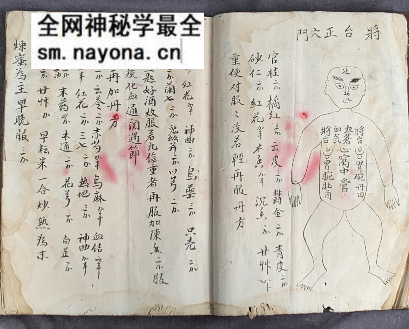 《梅山张五郎跌打医书》