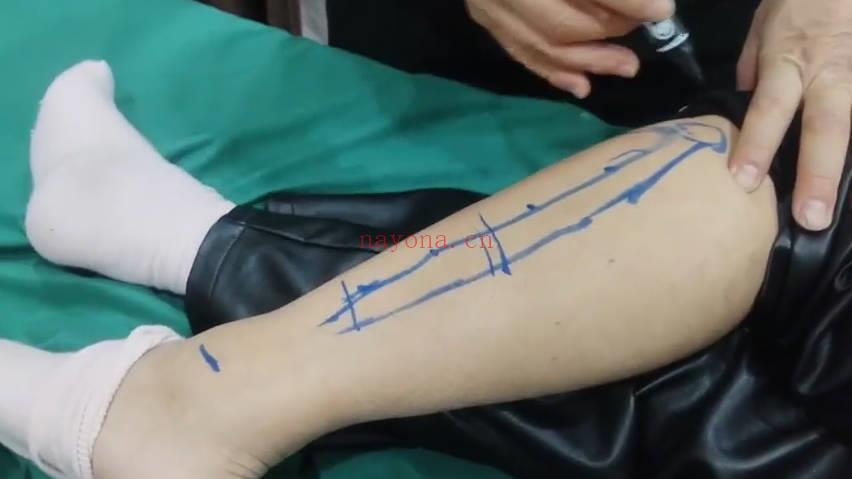 齐广发《张三丰秘传腿部养生绝学“武当逍遥十二厥”(小腿藏百病,厥通万病消)》8集视频课