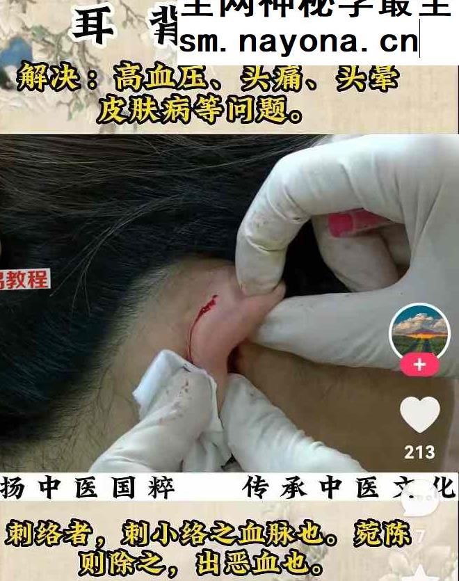高血压克星（PDF+视频+图片）原众筹价3980（中成药和泡脚方）