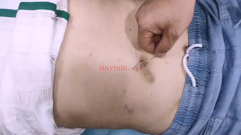 刘培杰 六阳道针《男科妇科疾病专题课》视频16集+4大密方文档