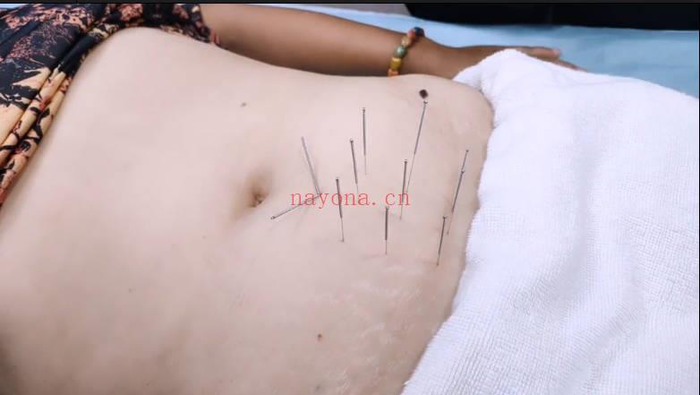 刘培杰 六阳道针《男科妇科疾病专题课》视频16集+4大密方文档