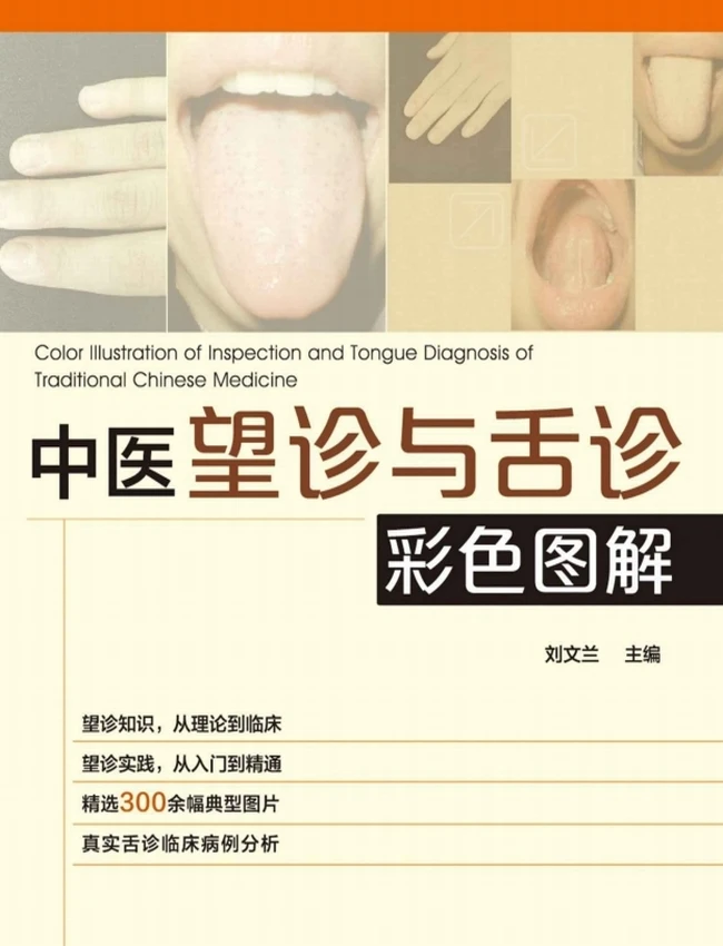 中医望诊与舌诊彩色图解插图 中医望诊与舌诊彩色图解插图