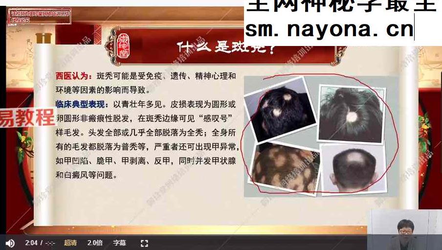 杨茜兰扶阳焕发术视频8集