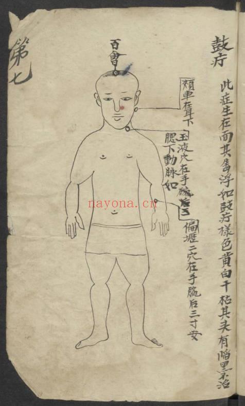 《百症图说》中医外科手抄本 141页.PDF电子版