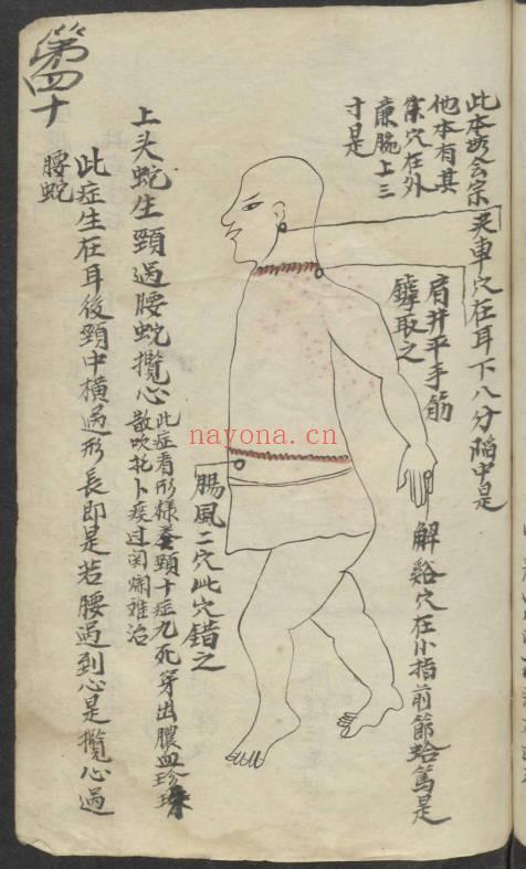 《百症图说》中医外科手抄本 141页.PDF电子版