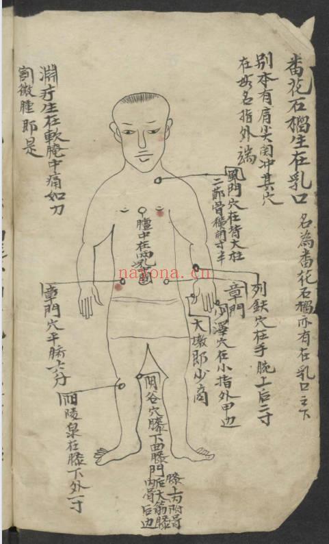 《百症图说》中医外科手抄本 141页.PDF电子版
