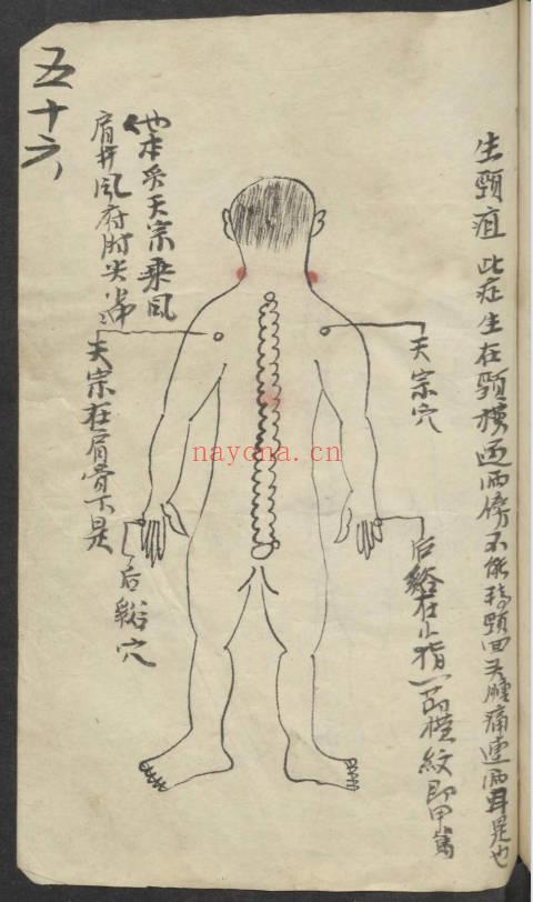 《百症图说》中医外科手抄本 141页.PDF电子版