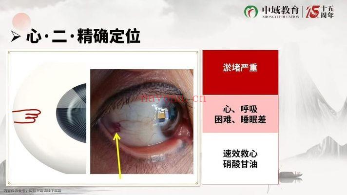 黄鑫《古法观目术》线上课 17集视频