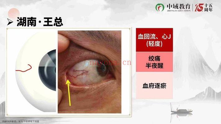 黄鑫《古法观目术》线上课 17集视频