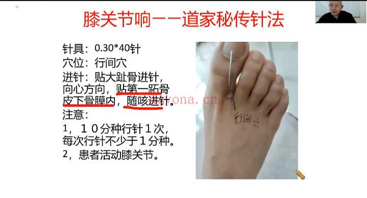 张宸菘《道家开关疗法绝技秘术》视频4集