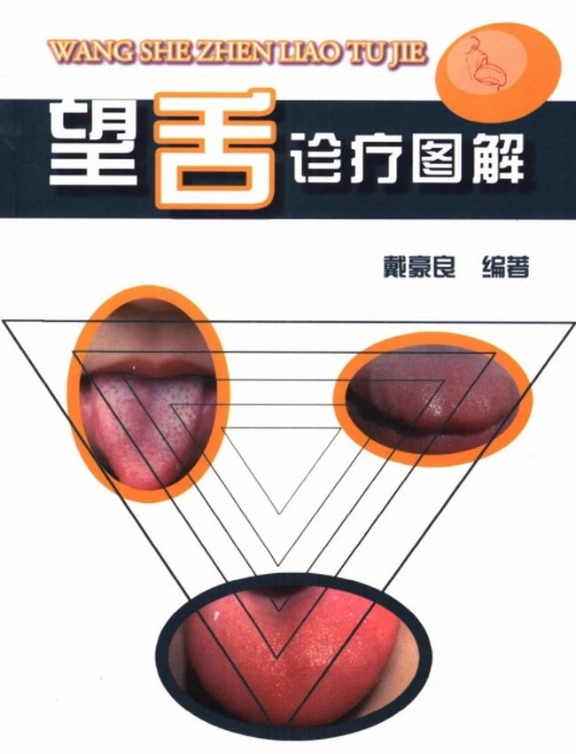 望舌诊疗图解插图