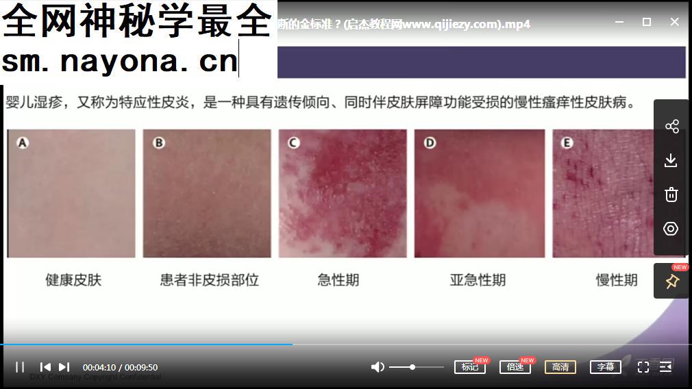 儿科医生基本功8大常见病诊疗宝典视频课程18集
