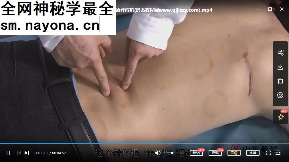 康合堂中医六法治痔疮视频课程4集