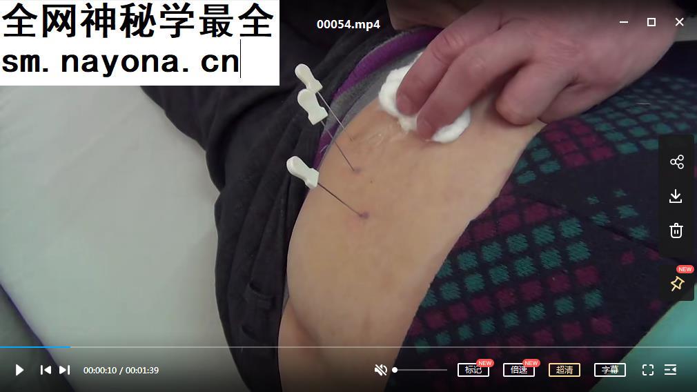 周中焕针刀培训班视频小针刀学习视频教程资料