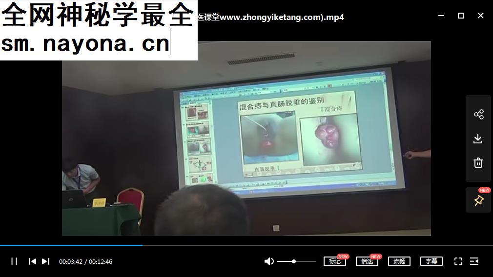 季宏伟痔疮断根疗法视频教程挑治龈交穴治疗痔疮