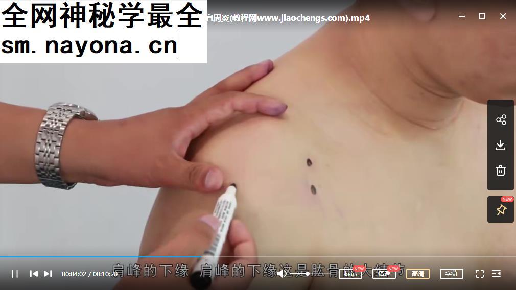 朱斌7天小针刀临床实操训练营视频课程10集小针刀教程
