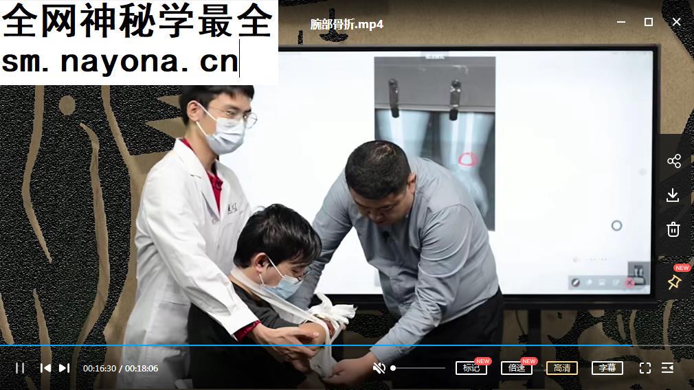 笵雨田0基础正骨必修课精读5大部位常见外伤X平片及实操处理视频课程7集