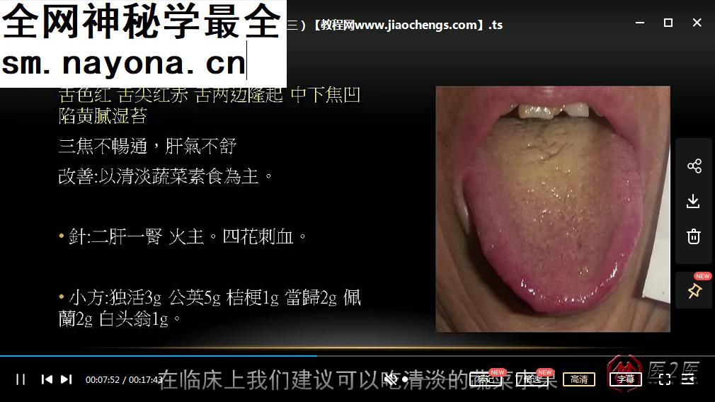 2020年张菁蓉四维舌诊郭氏舌诊视频课程12集百度云网盘下载学习中医舌诊教程-中医教程-启杰教程网