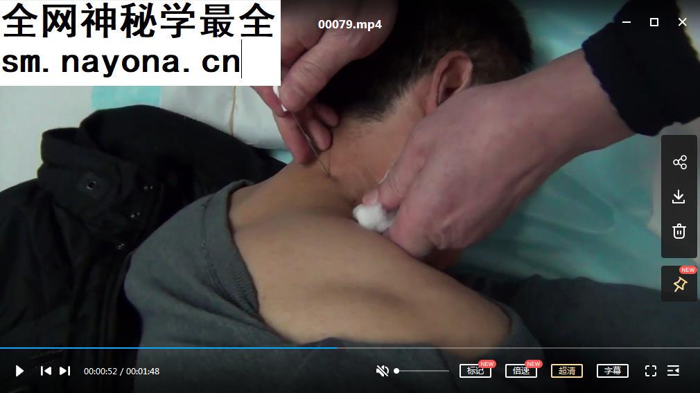 周中焕针刀培训班视频小针刀学习视频教程资料