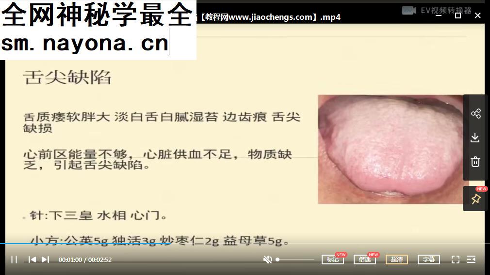 2021年张菁蓉零基础学舌诊视频课程75集学舌诊教程