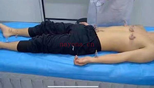 姚梅良《蒙医奇门罐阵》5集视频 理论 + 实操