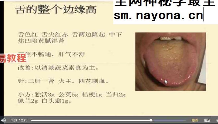 张菁蓉—零基础学舌诊75讲视频