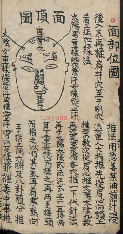 中医古籍《小儿各种惊图》177页 中医 第4张