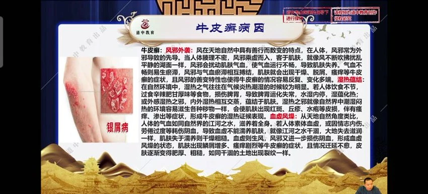 《道祖一消三愈针法》视频38集
