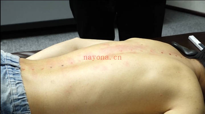 牛玺华华佗龙脊平衡术线上课50集视频 脊柱调理教程