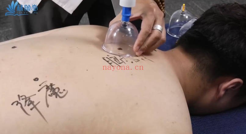 谢巍藏医换血术34集视频 藏医养生秘术